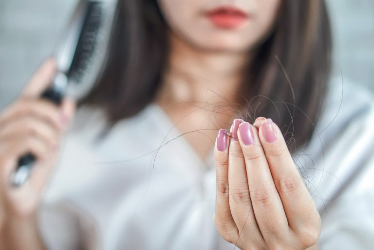 Covid et chute de cheveux, quelle relation ?