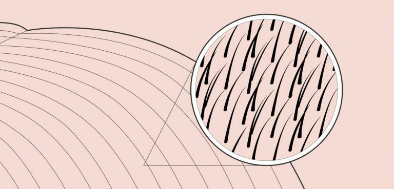 étude mondiale sur les cheveux