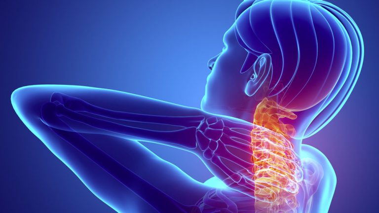 TMS, 75 % des coiffeurs concernés